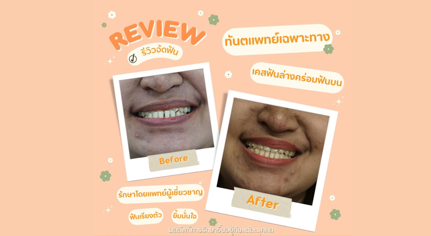 M Smile Dental Clinic (Amorini,Siam Park) M Smile Dental Clinic (Amorini,Siam Park) - เอ็มสไมล์คลินิกทัตกรรม คลินิกทันตกรรม สวนสยาม คันนายาว 6
