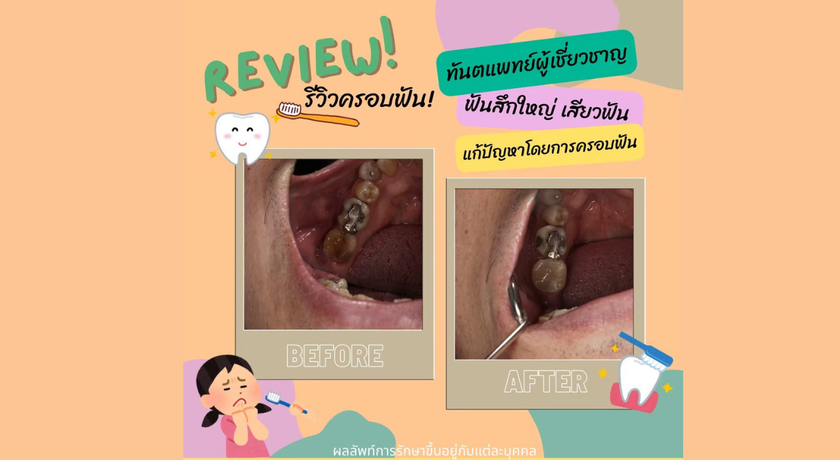 M Smile Dental Clinic (Amorini,Siam Park) M Smile Dental Clinic (Amorini,Siam Park) - เอ็มสไมล์คลินิกทัตกรรม คลินิกทันตกรรม สวนสยาม คันนายาว 9