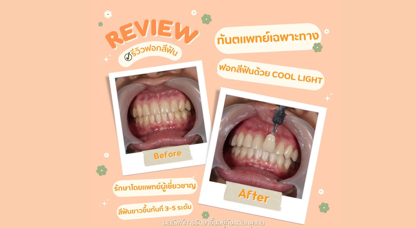 M Smile Dental Clinic (Amorini,Siam Park) M Smile Dental Clinic (Amorini,Siam Park) - เอ็มสไมล์คลินิกทัตกรรม คลินิกทันตกรรม สวนสยาม คันนายาว 11