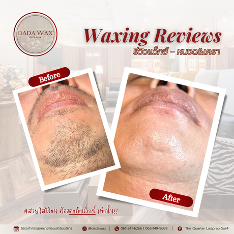 Dada Wax Dada Wax (ดาด้าแว็กซ์) - ร้านแว็กซ์ขนลาดพร้าว สปาผิว กำจัดขนทั้งชาย-หญิง 19