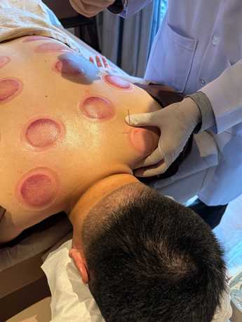 Yinyang Wellness (Asok Bangkok) Yinyang Wellness Asok Bangkok – หยินหยาง เวลเนส ฟื้นฟูอาการบาดเจ็บครบวงจร อโศก null?1782329474
