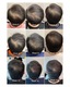 image_picker_532D8259-19F1-4DB5-A387-0DCCE51340F4-3256-00000098894FFABB
