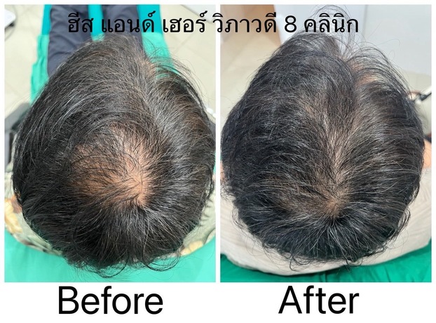 HIS and HER CLINIC (Vibhavadi 8) HIS and HER CLINIC (Vibhavadi 8) - ฮีส แอนด์ เฮอร์ วิภาวดี 8 บริการฟื้นฟูสุขภาพครบวงจร image_picker_248CB070-E580-4760-9A24-18960F232107-3256-000000988958B65F