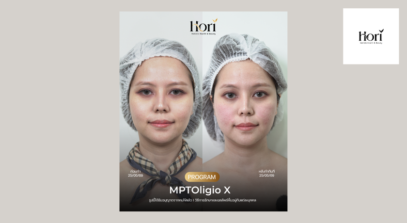 Hori Clinic (Times Square BTS Asoke) Hori Clinic (Times Square BTS Asoke) - โฮริ คลินิก อโศก 25