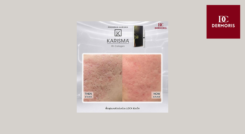 Dermoris Clinic (Premium Place MIX Ekkamai–Ramintra) Dermoris Clinic - เดอร์มอริส คลินิก นวลจันทร์ 25
