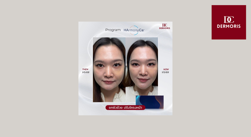 Dermoris Clinic (Premium Place MIX Ekkamai–Ramintra) Dermoris Clinic - เดอร์มอริส คลินิก นวลจันทร์ 30