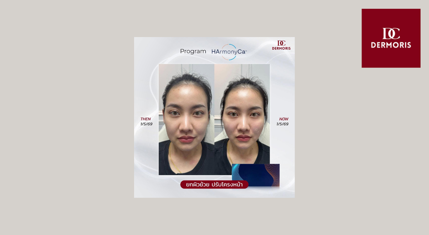 Dermoris Clinic (Premium Place MIX Ekkamai–Ramintra) Dermoris Clinic - เดอร์มอริส คลินิก นวลจันทร์ 31