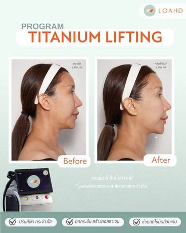 Loahd Clinic (BTS Asok) Loahd Clinic (BTS Asok) - โลอาห์ด คลินิก สุขุมวิท 25  (ETONNE  DNA ) 36374_0