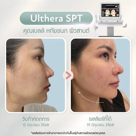 Loahd Clinic (BTS Asok) Loahd Clinic (BTS Asok) - โลอาห์ด คลินิก สุขุมวิท 25  (ETONNE  DNA ) 36397