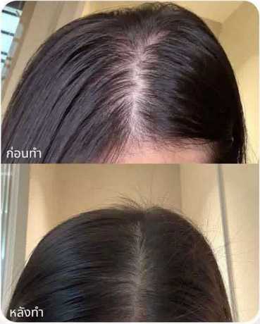 2N Clinic 2N Clinic - ทูเอ็นคลินิก เสริมความงาม เชียงใหม่ scaled_1000002956