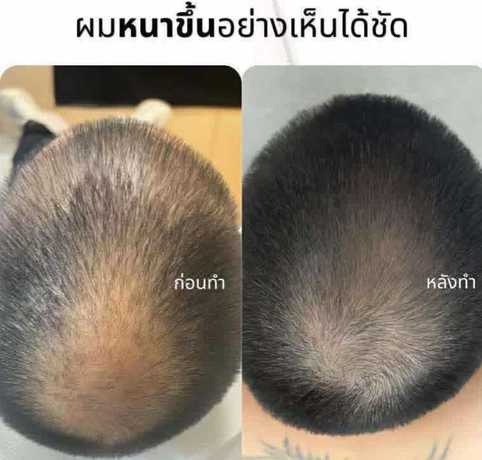 2N Clinic 2N Clinic - ทูเอ็นคลินิก เสริมความงาม เชียงใหม่ scaled_1000002955