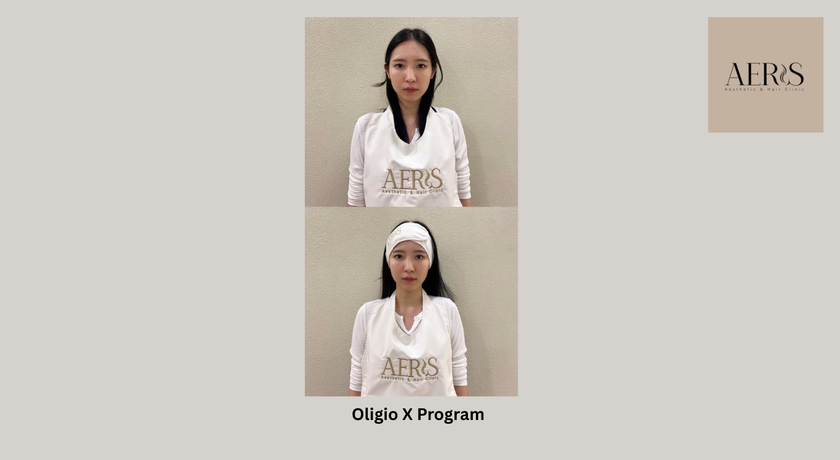Aeris Aesthetic & Hair Clinic (BTS Ratchadamri, Lumphini Park) Aeris Aesthetic & Hair Clinic (BTS Ratchadamri, Lumphini Park) - แอริส เอสเธติก แอนด์ แฮร์ คลินิก คลินิกเสริมความงามและดูแลเส้นผม ราชดำริ 4