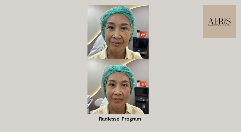 Aeris Aesthetic & Hair Clinic (BTS Ratchadamri, Lumphini Park) Aeris Aesthetic & Hair Clinic (BTS Ratchadamri, Lumphini Park) - แอริส เอสเธติก แอนด์ แฮร์ คลินิก คลินิกเสริมความงามและดูแลเส้นผม ราชดำริ 7