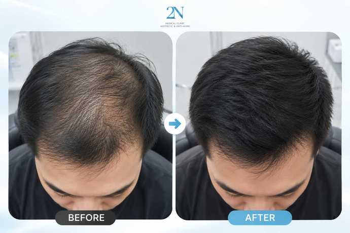 2N Clinic 2N Clinic - ทูเอ็นคลินิก เสริมความงาม เชียงใหม่ scaled_1000003351
