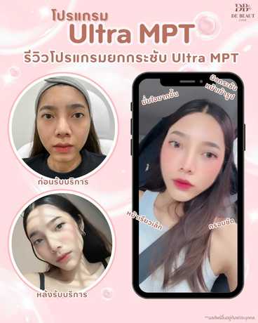 De Beaut Clinic (Prasert-Manukitch 48) De Beaut Clinic (Prasert-Manukitch 48) - เดอบิ้ว คลินิกเวชกรรม บริการความงามครบวงจร ย่านบึงกุ่ม scaled_1000001830