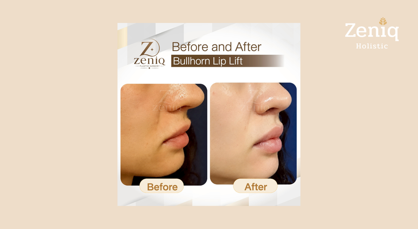 Zeniq Holistic Zeniq Holistic - เซนิก โฮลิสติก คลินิกความงาม นานา 15