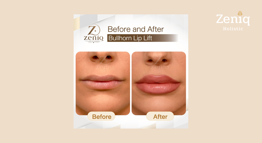 Zeniq Holistic Zeniq Holistic - เซนิก โฮลิสติก คลินิกความงาม นานา 17