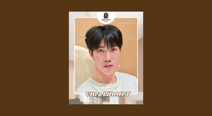Brown Clinic Brown Clinic - บราวน์ คลินิก คุณหมอดูแลเอง ย่านบางรัก 8