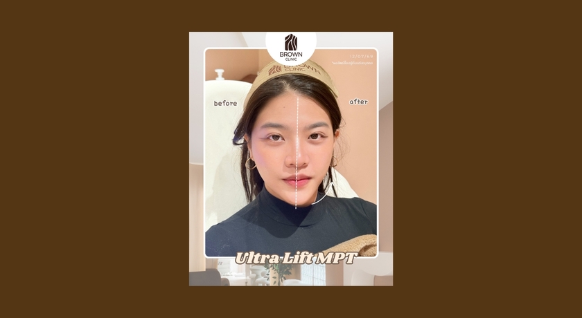 Brown Clinic Brown Clinic - บราวน์ คลินิก คุณหมอดูแลเอง ย่านบางรัก 9
