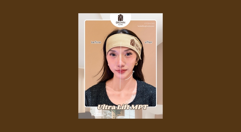 Brown Clinic Brown Clinic - บราวน์ คลินิก คุณหมอดูแลเอง ย่านบางรัก 10